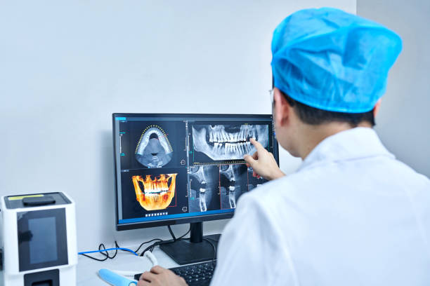 Best Emergency Tooth Extraction in Cumming, GA